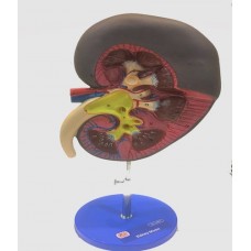 Kidney Model